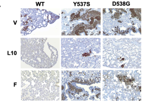 LAS at 10 mg/kg decreased lung metastases in all three mouse models as shown by IHC staining